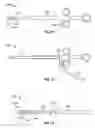 Fig. 08 - Vapor based ablation system for treating uterine bleeding