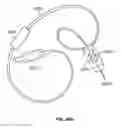 Fig. 136 - Vapor based ablation system for treating uterine bleeding
