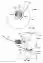 Fig. 158 - Vapor based ablation system for treating uterine bleeding