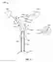 Fig. 32 - Vapor based ablation system for treating uterine bleeding