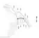 Fig. 40 - Vapor based ablation system for treating uterine bleeding