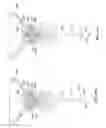 Fig. 41 - Vapor based ablation system for treating uterine bleeding