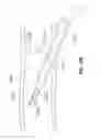 Fig. 53 - Vapor based ablation system for treating uterine bleeding