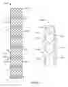 Fig. 74 - Vapor based ablation system for treating uterine bleeding