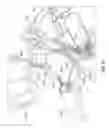 Fig. 84 - Vapor based ablation system for treating uterine bleeding