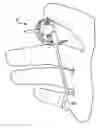 Fig. 01 - Dental implant screwdriver harness system