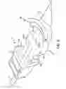 Fig. 04 - Dental implant screwdriver harness system
