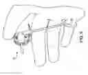 Fig. 09 - Dental implant screwdriver harness system