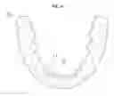 Fig. 06 - Orthodontic digital bracket for using digital library and method of manufacturing the same