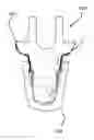 Fig. 01 - Tooth implant system