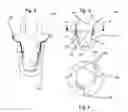 Fig. 03 - Tooth implant system