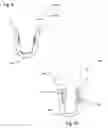 Fig. 05 - Tooth implant system