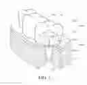 Fig. 02 - ARTIFICIAL DENTURE