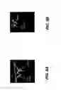 Fig. 09 - Intraoral 3D scanner with fluid segmentation
