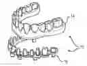 Fig. 01 - SYSTEM AND METHOD FOR MANUFACTURING DENTAL DEVICE