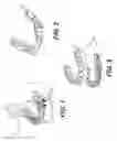 Fig. 02 - SYSTEM AND METHOD FOR MANUFACTURING DENTAL DEVICE