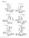 Fig. 20 - Partial dental arch and method for manufacturing a partial arch