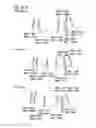 Fig. 33 - Partial dental arch and method for manufacturing a partial arch
