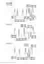 Fig. 47 - Partial dental arch and method for manufacturing a partial arch