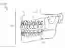 Fig. 01 - Temporal mandible data capture analysis and recommendation