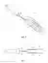 Fig. 06 - Device and method for mitigating the ascension of testicles during castration of livestock