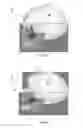 Fig. 02 - Adjustable facial implant device