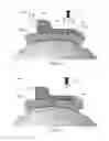 Fig. 03 - Adjustable facial implant device