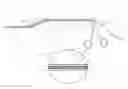 Fig. 01 - IVC FILTER RETRIEVAL KIT