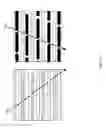 Fig. 148 - Systems for aspirating thrombus during neurosurgical procedures