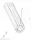 Fig. 167 - Systems for aspirating thrombus during neurosurgical procedures