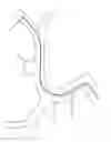 Fig. 236 - Systems for aspirating thrombus during neurosurgical procedures