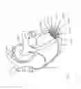 Fig. 252 - Systems for aspirating thrombus during neurosurgical procedures