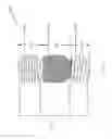 Fig. 40 - Systems for aspirating thrombus during neurosurgical procedures