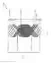 Fig. 44 - Systems for aspirating thrombus during neurosurgical procedures