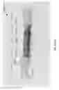Fig. 61 - Systems for aspirating thrombus during neurosurgical procedures