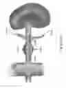 Fig. 64 - Systems for aspirating thrombus during neurosurgical procedures