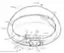 Fig. 01 - Adjustable implant