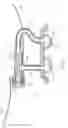 Fig. 07 - Adjustable implant