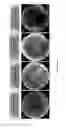 Fig. 04 - Artificial silk based innervated cornea