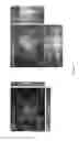 Fig. 08 - Artificial silk based innervated cornea