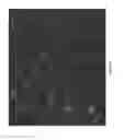 Fig. 19 - Artificial silk based innervated cornea
