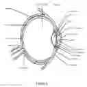 Fig. 02 - Exocapsular device and method for lens stabilization
