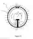 Fig. 03 - Exocapsular device and method for lens stabilization