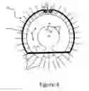 Fig. 05 - Exocapsular device and method for lens stabilization