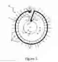 Fig. 06 - Exocapsular device and method for lens stabilization