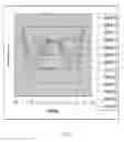 Fig. 07 - Blended extended depth of focus light adjustable lens with laterally offset axes