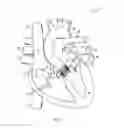 Fig. 02 - Heart valve prosthesis