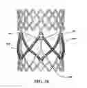 Fig. 35 - METHODS OF MAKING DURABLE MULTI-LAYER HIGH STRENGTH POLYMER COMPOSITE SUITABLE FOR IMPLANT AND ARTICLES PRODUCED THEREFROM