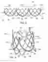 Fig. 03 - Leaflet attachment frame for a prosthetic valve
