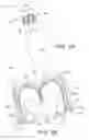 Fig. 06 - Segmented, growth-accommodating, artificial valve